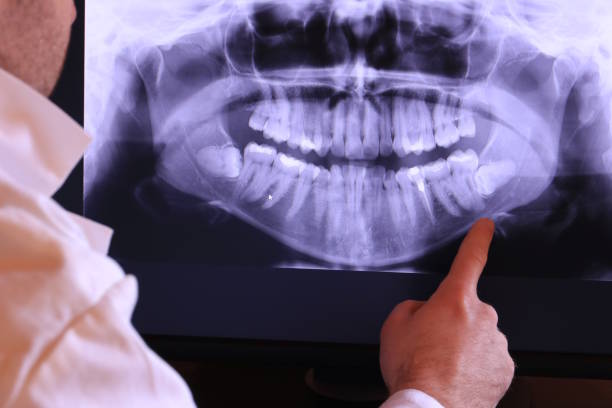 Best Emergency Root Canal Treatment in Mineola, TX