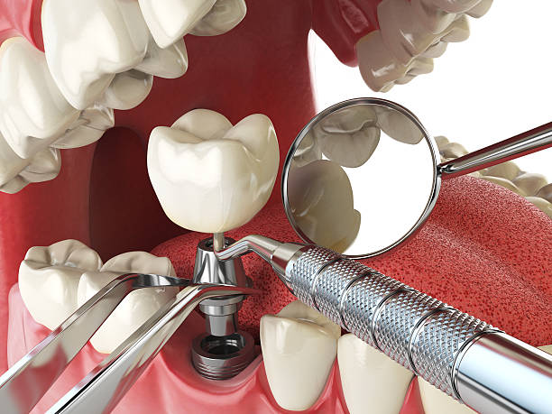 Best Emergency Orthodontic Repairs in Mineola, TX